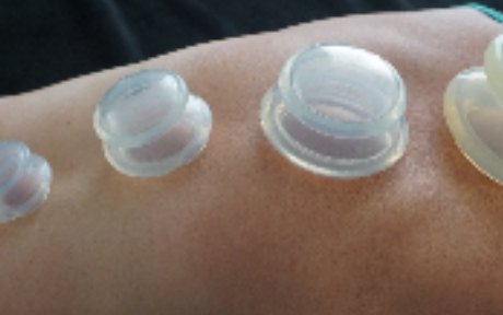 Cupping
